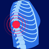Icons_Extremity_Spine