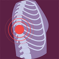 Icons_Extremity_Spine_Purple