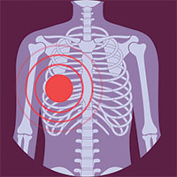 Icons_Thorax_Purple