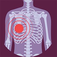 Icons_Thorax_Purple